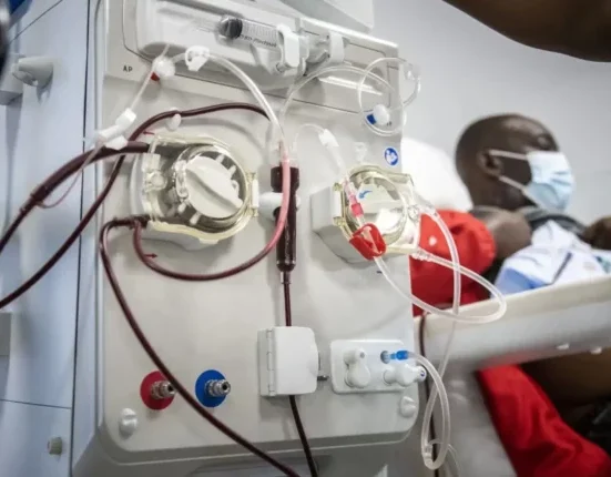 Dialysis machine 750x430, asibitocin